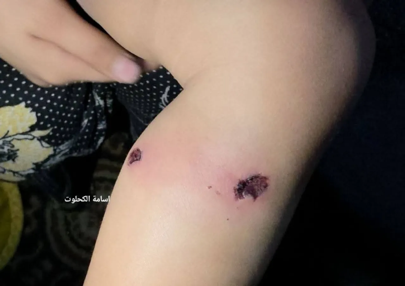 Żydonaziści torturowali palestyńskiego niemowlaka, by zmusić jego ojca do zeznań