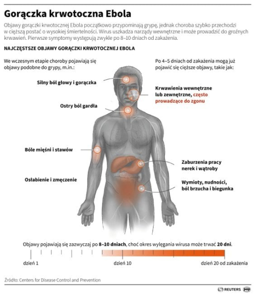 W Ugandzie Ebola, ale eksperci z NIK tam pojechali